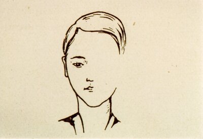 Negative scotoma drawn by a migraine sufferer