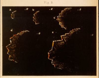 Illustration of visual migraine aura from 1870