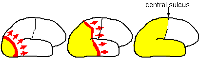 Lateral views of human brain with different time intervals after start of attack