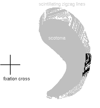 Part of fortification
