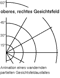 Animated scotoma